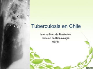Tuberculosis en Chile
Interna Marcela Barrientos
Sección de Kinesiología
HBPM
 