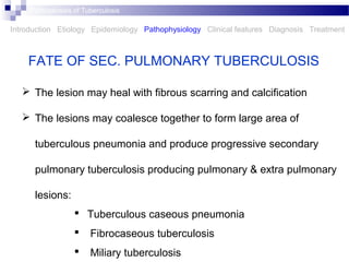  The lesion may heal with fibrous scarring and calcification
 The lesions may coalesce together to form large area of
tuberculous pneumonia and produce progressive secondary
pulmonary tuberculosis producing pulmonary & extra pulmonary
lesions:
 Tuberculous caseous pneumonia
 Fibrocaseous tuberculosis
 Miliary tuberculosis
FATE OF SEC. PULMONARY TUBERCULOSIS
Introduction Etiology Epidemiology Pathophysiology Clinical features Diagnosis Treatment
Pathogenesis of Tuberculosis
 