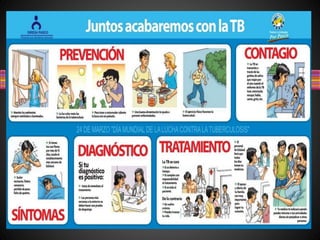 Tuberculosis