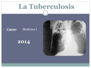 La Tuberculosis 
• Curso: Medicina I 
2014 
 