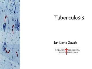 Tuberculosis
Dr. David Zavala
 
