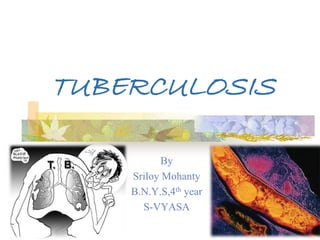 TUBERCULOSIS 
By 
Sriloy Mohanty 
B.N.Y.S,4th year 
S-VYASA 
 