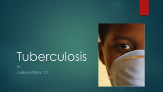 Tuberculosis
BY:
KARIM HUSSEIN 727
 