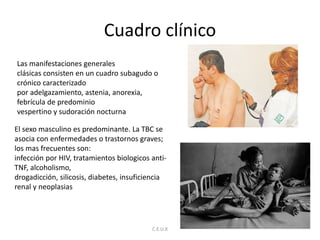 Cuadro clínico
C.E.U.X
Las manifestaciones generales
clásicas consisten en un cuadro subagudo o
crónico caracterizado
por adelgazamiento, astenia, anorexia,
febrícula de predominio
vespertino y sudoración nocturna
El sexo masculino es predominante. La TBC se
asocia con enfermedades o trastornos graves;
los mas frecuentes son:
infección por HIV, tratamientos biologicos anti-
TNF, alcoholismo,
drogadicción, silicosis, diabetes, insuficiencia
renal y neoplasias
 