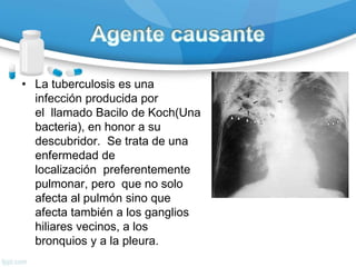 • La tuberculosis es una
infección producida por
el llamado Bacilo de Koch(Una
bacteria), en honor a su
descubridor. Se trata de una
enfermedad de
localización preferentemente
pulmonar, pero que no solo
afecta al pulmón sino que
afecta también a los ganglios
hiliares vecinos, a los
bronquios y a la pleura.
 