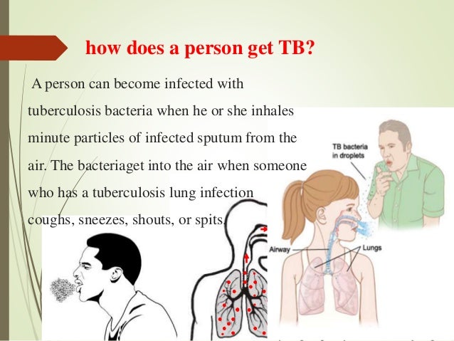 how tb get Tuberculosis TB how tb get Tuberculosis TB