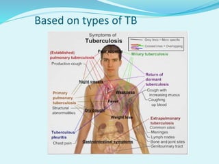 Based on types of TB
 