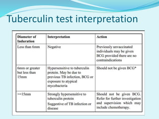 Tuberculin test interpretation
 