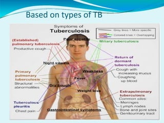 Based on types of TB
 
