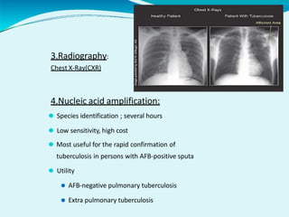 3.Radiography:
Chest X-Ray(CXR)
4.Nucleic acid amplification:
⚫ Species identification ; several hours
⚫ Low sensitivity, high cost
⚫ Most useful for the rapid confirmation of
tuberculosis in persons with AFB-positive sputa
⚫ Utility
⚫ AFB-negative pulmonary tuberculosis
⚫ Extra pulmonary tuberculosis
 