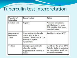 Tuberculin test interpretation
 