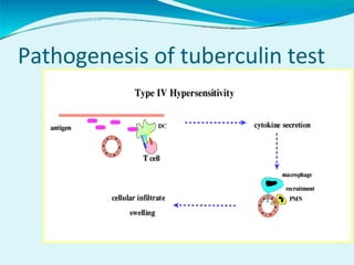 Pathogenesis of tuberculin test
 