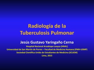 Radiología de la
Tuberculosis Pulmonar
Jesús Gustavo Yaringaño Cerna
Hospital Nacional Arzobispo Loayza (HNAL)
Universidad de San Martín de Porres – Facultad de Medicina Humana (FMH-USMP)
Sociedad Científica Unida de Estudiantes de Medicina (SCUEM)
Lima, 2015
 