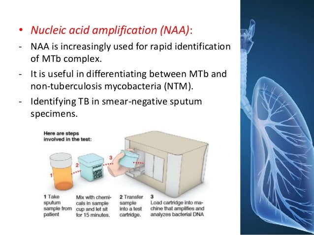 tuberculosis nucleic acid amplification test