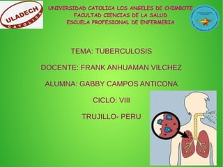 UNIVERSIDAD CATOLICA LOS ANGELES DE CHIMBOTE
FACULTAD CIENCIAS DE LA SALUD
ESCUELA PROFESIONAL DE ENFERMERIA
TEMA: TUBERCULOSIS
DOCENTE: FRANK ANHUAMAN VILCHEZ
ALUMNA: GABBY CAMPOS ANTICONA
CICLO: VIII
TRUJILLO- PERU
 