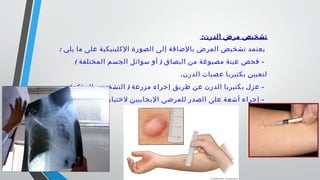 :‫الدرن‬ ‫مرض‬ ‫تشخيص‬:‫الدرن‬ ‫مرض‬ ‫تشخيص‬
: ‫يلي‬ ‫ما‬ ‫على‬ ‫الكلينيكية‬ ‫الصورة‬ ‫إلى‬ ‫بالضافة‬ ‫المرض‬ ‫تشخيص‬ ‫يعتمد‬
( ) -‫المختلفة‬ ‫الجسم‬ ‫سوائل‬ ‫أو‬ ‫البصاق‬ ‫من‬ ‫مصبوغة‬ ‫عينة‬ ‫فحص‬
.‫الدرن‬ ‫عصيات‬ ‫بكتيريا‬ ‫لتعيين‬
.( ) -‫المؤكد‬ ‫التشخيص‬ ‫مزرعة‬ ‫إجراء‬ ‫طريق‬ ‫عن‬ ‫الدرن‬ ‫بكتيريا‬ ‫عزل‬
. -‫تيبوركلين‬ ‫لختبار‬ ‫اليجابيين‬ ‫للمرضى‬ ‫الصدر‬ ‫على‬ ‫أشعة‬ ‫إجراء‬
 