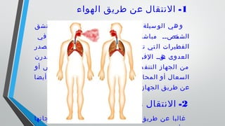  1-‫الهواء‬ ‫طريق‬ ‫عن‬ ‫النتقال‬
‫يستنشق‬ ‫يث‬ ‫ح‬ ‫العدوى‬ ‫قل‬ ‫لن‬ ‫سية‬ ‫الرئي‬ ‫سيلة‬ ‫الو‬ ‫هي‬ ‫و‬
‫في‬ ‫الموجودة‬ ‫الدرن‬ ‫ييييييات‬‫عص‬ ‫مباشرة‬ ‫ييصيي‬‫الشخ‬
‫ومصدر‬ ،‫يض‬ ‫المر‬ ‫نف‬ ‫أ‬ ‫أو‬ ‫فم‬ ‫من‬ ‫تخرج‬ ‫تي‬ ‫ال‬ ‫القطيرات‬
‫الدرن‬ ‫عصيات‬ ‫وتخرج‬ ،‫يية‬‫ي‬‫يي‬‫التنفس‬ ‫الفرازات‬ ‫يويي‬‫ه‬ ‫العدوى‬
‫أو‬ ‫طس‬ ‫الع‬ ‫أثناء‬ ‫يض‬ ‫للمر‬ ‫العلوي‬ ‫سي‬ ‫التنف‬ ‫الجهاز‬ ‫من‬
‫أيضا‬ ‫صاب‬‫الم‬ ‫خص‬‫الش‬ ‫لى‬‫إ‬ ‫خل‬‫وتد‬ ‫ثة‬‫المحاد‬ ‫أو‬ ‫سعال‬‫ال‬
.‫العلوي‬ ‫التنفسي‬ ‫الجهاز‬ ‫طريق‬ ‫عن‬
2-‫البلع‬ ‫طريق‬ ‫عن‬ ‫النتقال‬
‫ومنتجاتها‬ ‫المبسترة‬ ‫غير‬ ‫اللبان‬ ‫تناول‬ ‫طريق‬ ‫عن‬ ‫غالبا‬
 