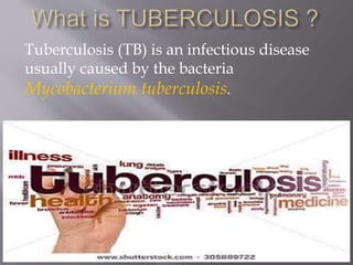 Tuberculosis (TB) is an infectious disease
usually caused by the bacteria
Mycobacterium tuberculosis.
 