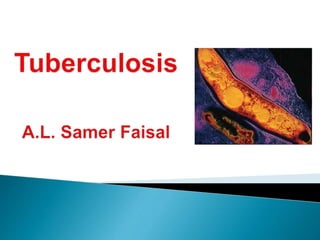M. tuberculosis
 