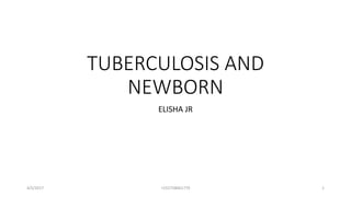 TUBERCULOSIS AND
NEWBORN
ELISHA JR
4/5/2017 +255758061770 1
 