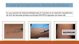 diagnostico bacteriológico de tuberculosis y micobacterias | PPTX