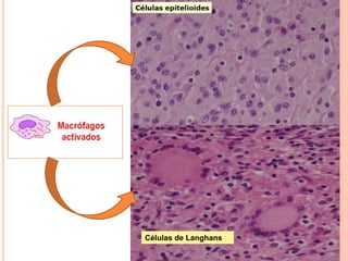 Células de Langhans
 