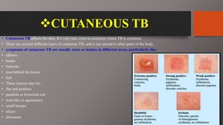 CUTANEOUS TB
• Cutaneous TB affects the skin. It’s very rare, even in countries where TB is common.
• There are several different types of cutaneous TB, and it can spread to other parts of the body.
• symptoms of cutaneous TB are usually sores or lesions in different areas, particularly the:
• elbows
• hands
• buttocks
• area behind the knees
• feet
• These lesions may be:
• flat and painless
• purplish or brownish-red
• wart-like in appearance
• small bumps
• ulcers
• abscesses
 