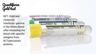 Qft Test Tuberculosis | PPTX