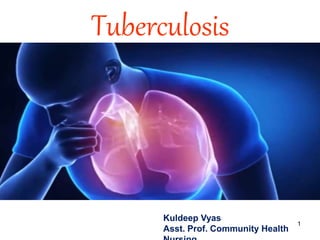 Tuberculosis
1
Kuldeep Vyas
Asst. Prof. Community Health
 