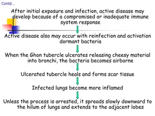 Contd…
After initial exposure and infection, active disease may
develop because of a compromised or inadequate immune
system response
Active disease also may occur with reinfection and activation
dormant bacteria
When the Ghon tubercle ulcerates releasing cheesy material
into bronchi, the bacteria becomes airborne
Ulcerated tubercle heals and forms scar tissue
Infected lungs become more inflamed
Unless the process is arrested, it spreads slowly downward to
the hilum of lungs and extends to the adjacent lobes
 
