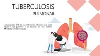 TUBERCULOSIS
PULMONAR
La tuberculosis (TB) es una enfermedad infecciosa que suele
afectar a los pulmones y es causada por una bacteria
(Mycobacterium tuberculosis).
 