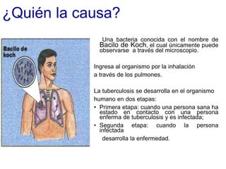 ¿Quién la causa?
Una bacteria conocida con el nombre de
Bacilo de Koch, el cual únicamente puede
observarse a través del microscopio.
Ingresa al organismo por la inhalación
a través de los pulmones.
La tuberculosis se desarrolla en el organismo
humano en dos etapas:
• Primera etapa: cuando una persona sana ha
estado en contacto con una persona
enferma de tuberculosis y es infectada;
• Segunda etapa: cuando la persona
infectada
desarrolla la enfermedad.
 