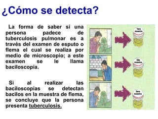 ¿Cómo se detecta?
La forma de saber si una
persona padece de
tuberculosis pulmonar es a
través del examen de esputo o
flema el cual se realiza por
medio de microscopio; a este
examen se le llama
baciloscopía.
Si al realizar las
baciloscopias se detectan
bacilos en la muestra de flema,
se concluye que la persona
presenta tuberculosis.
 
