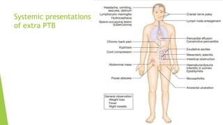 Systemic presentations
of extra PTB
 