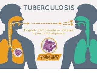 tuberculosis.pptx