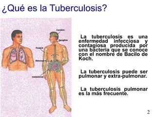 ¿Qué es la Tuberculosis?
La tuberculosis es una
enfermedad infecciosa y
contagiosa producida por
una bacteria que se conoce
con el nombre de Bacilo de
Koch.
La tuberculosis puede ser
pulmonar y extra-pulmonar.
La tuberculosis pulmonar
es la más frecuente.
2
 