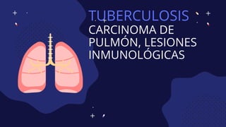 TUBERCULOSIS
CARCINOMA DE
PULMÓN, LESIONES
INMUNOLÓGICAS
 
