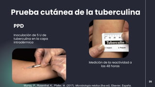 PPD
Inoculación de 5 U de
tuberculina en la capa
intradérmica
Medición de la reactividad a
las 48 horas
Prueba cutánea de la tuberculina
35
Murray, P., Rosenthal, K., Pfaller, M. (2017). Microbiología médica (8va ed). Elsevier, España.
 