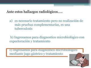 Ante estos hallazgos radiológicos…..
a) es necesario tratamiento pero no realización de
más pruebas complementarias, es una
tuberculosis
b) Ingresamos para diagnostico microbiológico con
expectoración y tratamiento
c) Ingresamos para diagnostico microbiológico
mediante jugo gástrico y tratamiento
 