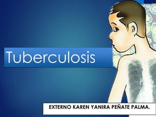Tuberculosis
EXTERNO KAREN YANIRA PEÑATE PALMA.
 