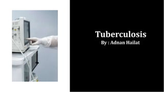 Tuberculosis
By : Adnan Hailat
 