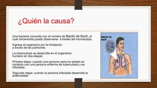 ¿Quién la causa?
Una bacteria conocida con el nombre de Bacilo de Koch, el
cual únicamente puede observarse a través del microscopio.
Ingresa al organismo por la inhalación
a través de los pulmones.
La tuberculosis se desarrolla en el organismo
humano en dos etapas:
Primera etapa: cuando una persona sana ha estado en
contacto con una persona enferma de tuberculosis y es
infectada;
Segunda etapa: cuando la persona infectada desarrolla la
enfermedad
 