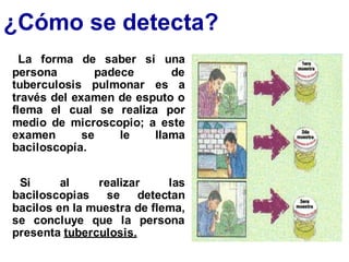 ¿Cómo se detecta?
La forma de saber si una
persona padece de
tuberculosis pulmonar es a
través del examen de esputo o
flema el cual se realiza por
medio de microscopio; a este
examen se le llama
baciloscopía.
Si al realizar las
baciloscopias se detectan
bacilos en la muestra de flema,
se concluye que la persona
presenta tuberculosis.
 