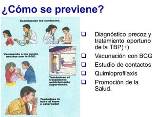 ¿Cómo se previene?
❑ Diagnóstico precoz y
tratamiento oportuno
de la TBP(+)
❑ Vacunación con BCG
❑ Estudio de contactos
❑ Quimioprofilaxis
❑ Promoción de la
Salud.
 