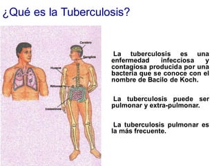 ¿Qué es la Tuberculosis?
La tuberculosis es una
enfermedad infecciosa y
contagiosa producida por una
bacteria que se conoce con el
nombre de Bacilo de Koch.
La tuberculosis puede ser
pulmonar y extra-pulmonar.
La tuberculosis pulmonar es
la más frecuente.
 