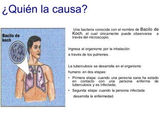 ¿Quién la causa?
Una bacteria conocida con el nombre de Bacilo de
Koch, el cual únicamente puede observarse a
través del microscopio.
Ingresa al organismo por la inhalación
a través de los pulmones.
La tuberculosis se desarrolla en el organismo
humano en dos etapas:
• Primera etapa: cuando una persona sana ha estado
en contacto con una persona enferma de
tuberculosis y es infectada;
• Segunda etapa: cuando la persona infectada
desarrolla la enfermedad.
 