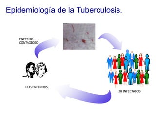 Epidemiología de la Tuberculosis.
DOS ENFERMOS
ENFERMO
CONTAGIOSO
20 INFECTADOS
 