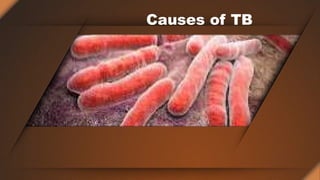 Causes of TB
 