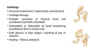 Pathology
• Synovial Involvement ( hypertrophy and effusion)
• Cartilage damage
• Multiple cavitation in femoral head and
acetabulum (partially absorbed)
• Subluxation or dislocation of head (wandering
acetabulum) due to muscle pull
• Cold abscess in later stages ( bursting of pus in
capsule)
• Healing – Fibrous ankylosis
 