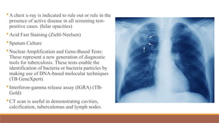 A chest x-ray is indicated to rule out or rule in the
presence of active disease in all screening test-
positive cases. (hilar opacities)
Acid Fast Staining (Ziehl-Neelsen)
Sputum Culture
Nuclear Amplification and Gene-Based Tests:
These represent a new generation of diagnostic
tools for tuberculosis. These tests enable the
identification of bacteria or bacteria particles by
making use of DNA-based molecular techniques
(TB GeneXpert).
Interferon-gamma release assay (IGRA) (TB-
Gold)
CT scan is useful in demonstrating cavities,
calcification, tuberculomas and lymph nodes.
 